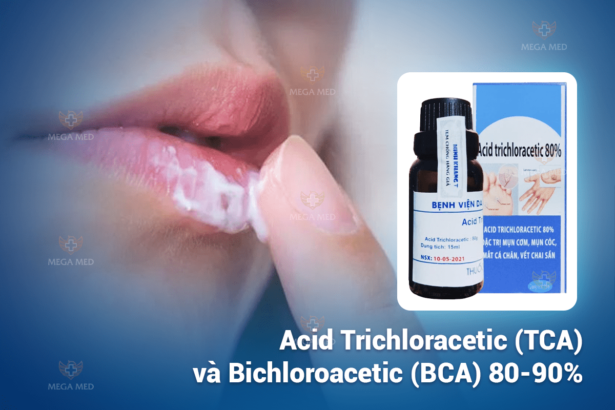 Thuốc trị sùi mào gà bôi ở lưỡi